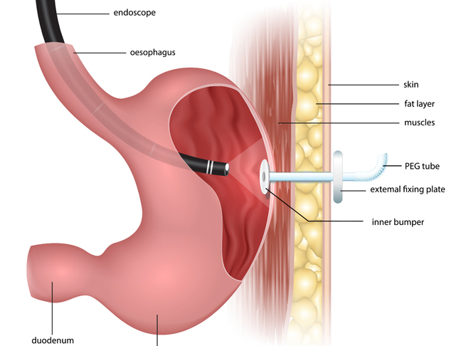 gastroenterology research and practice