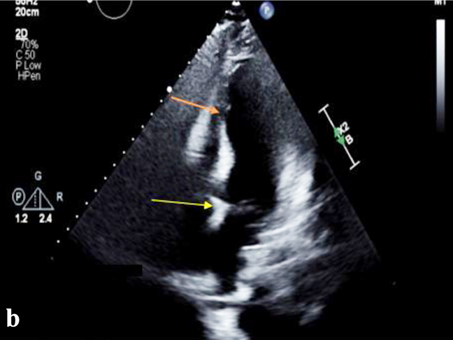 gastroenterology research and practice journal