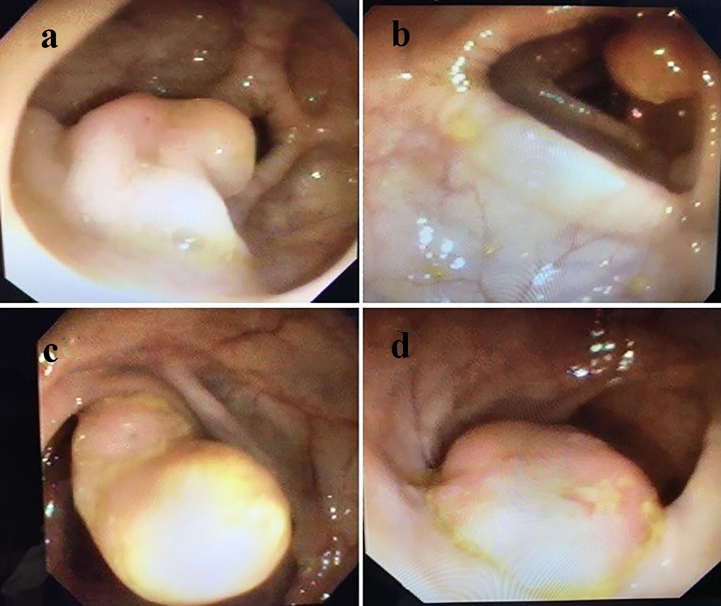 Figure 3. 