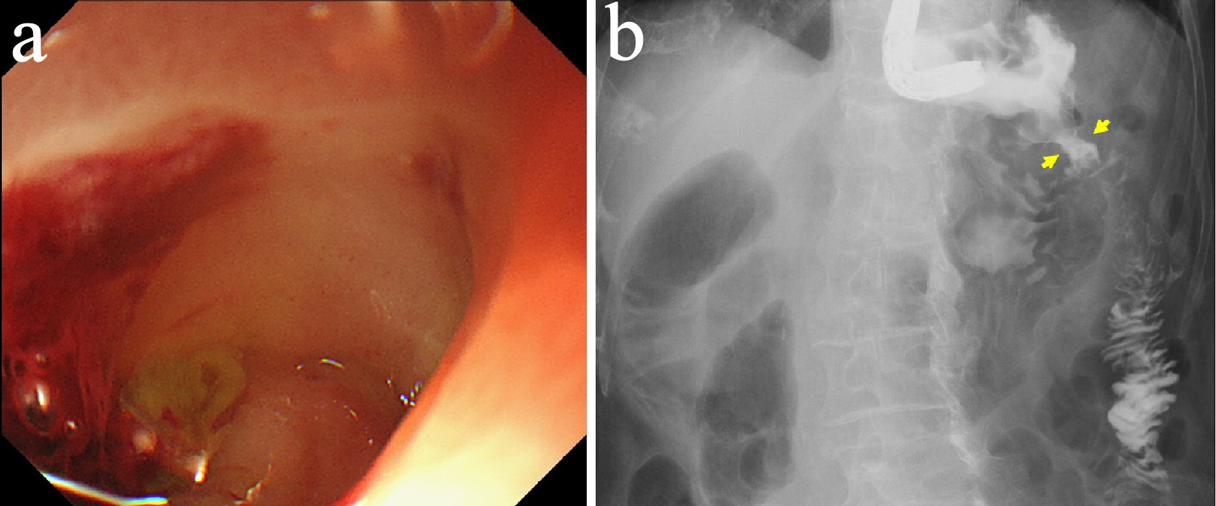 Figure 3. 