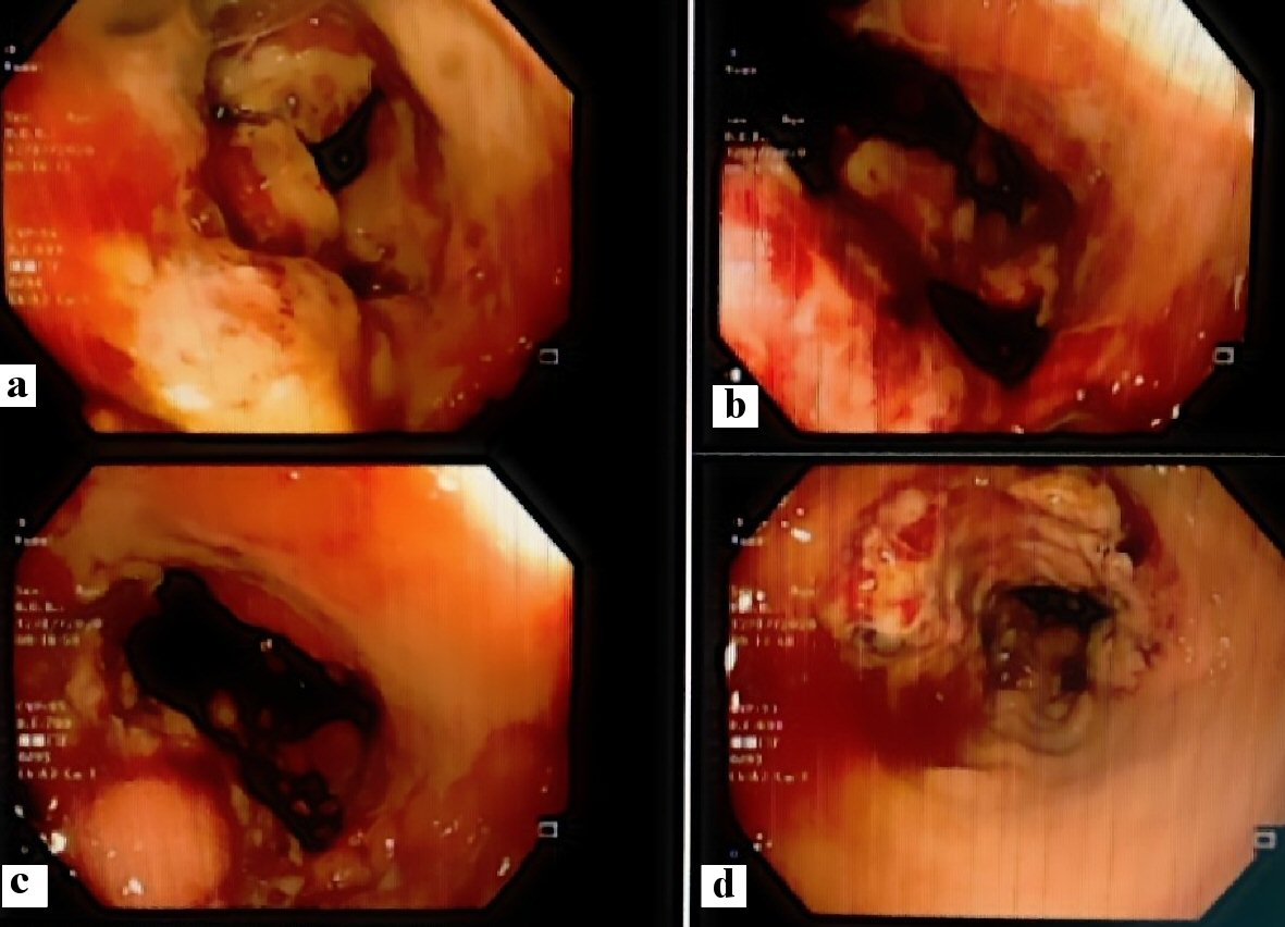 Figure 4. 