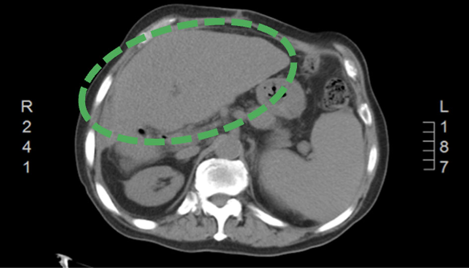 Figure 3. 