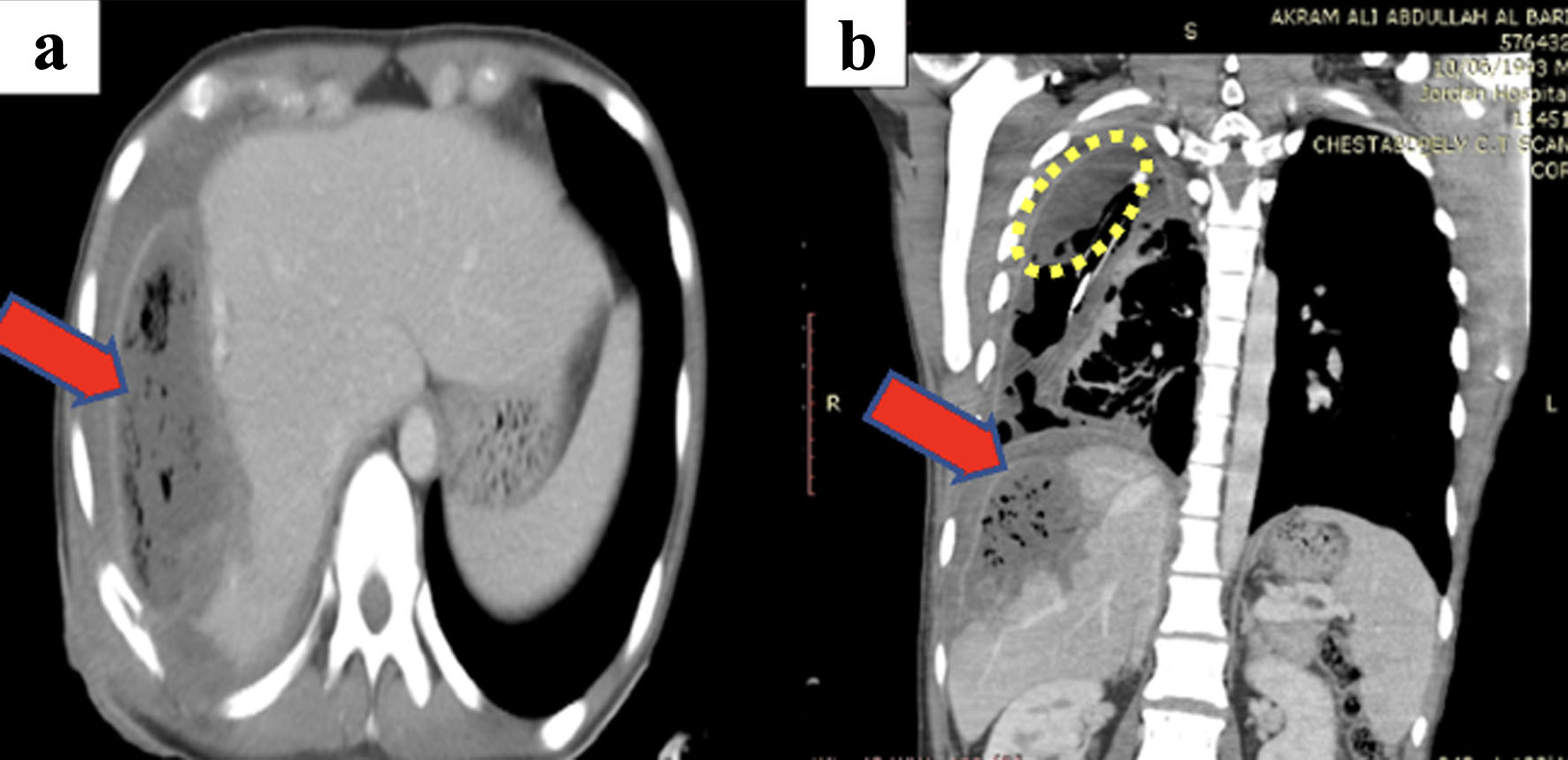 Figure 10. 