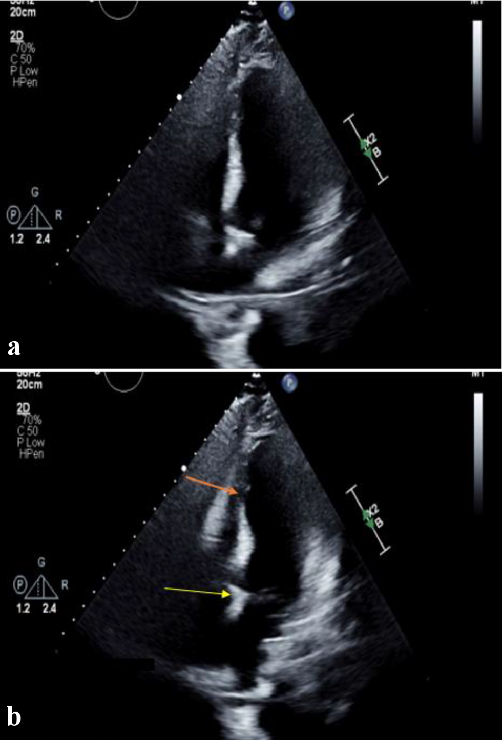 Figure 3. 