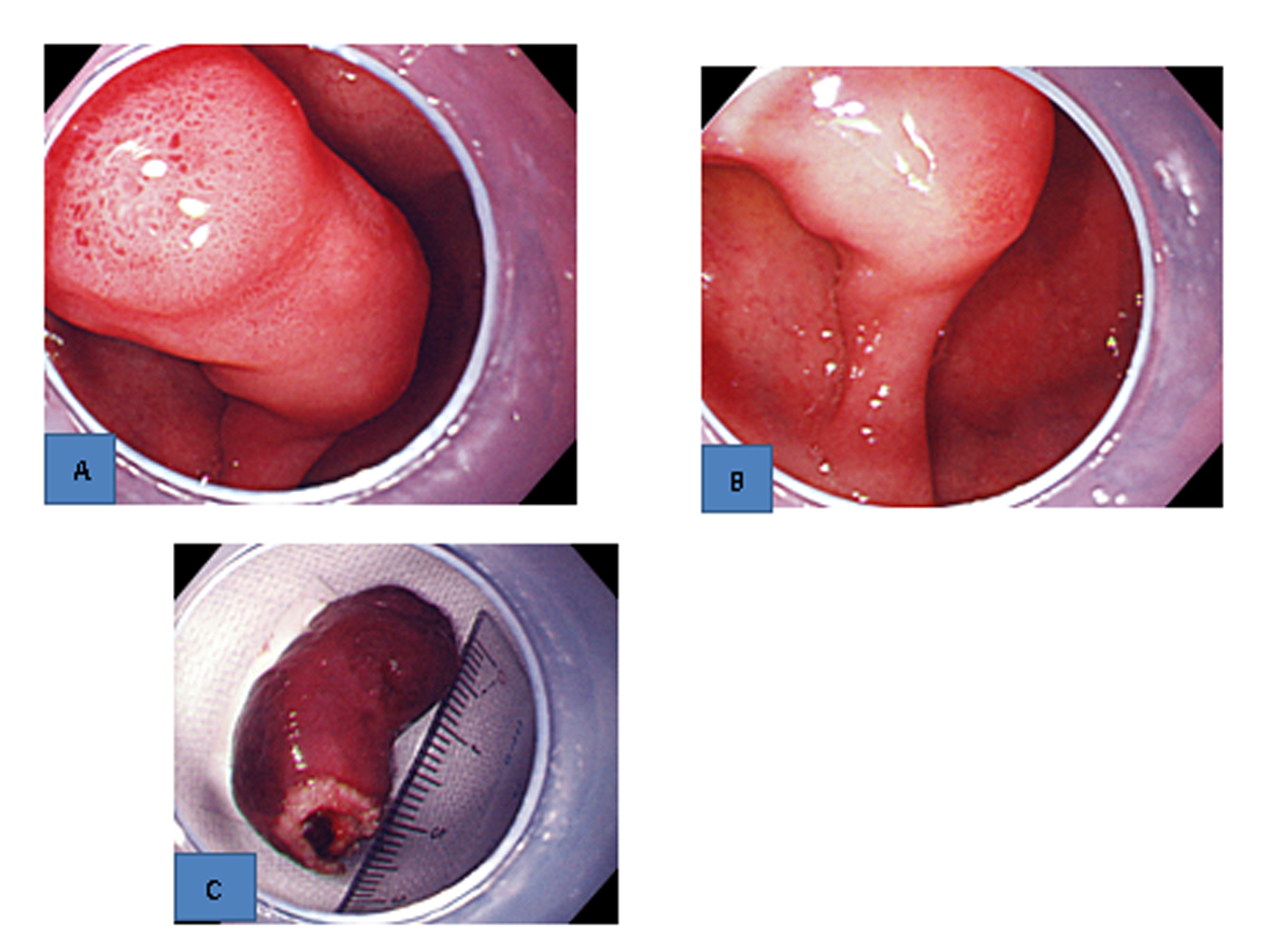 Figure 2. 