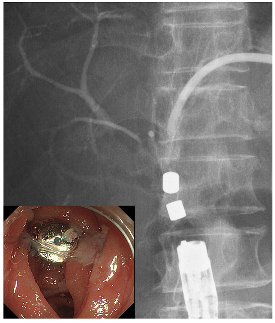 Figure 3. 